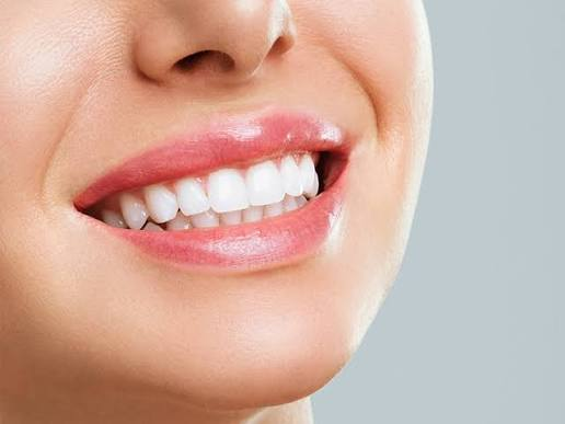 Smile Makeover